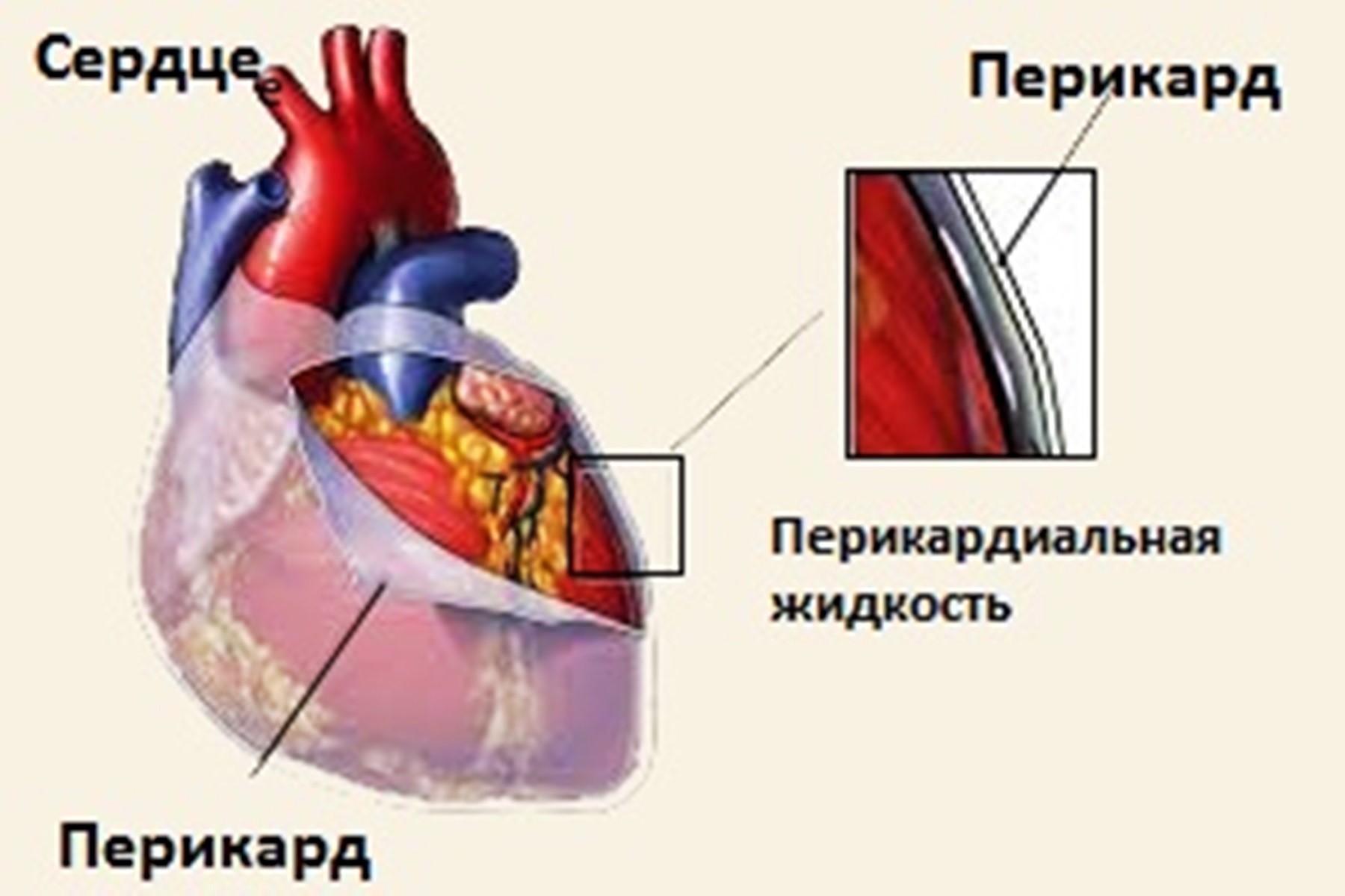 Скопление воздуха в перикарде латынь. Сердце человека перикард. Перикард (околосердечная сумка). Строение перикарда сердца.